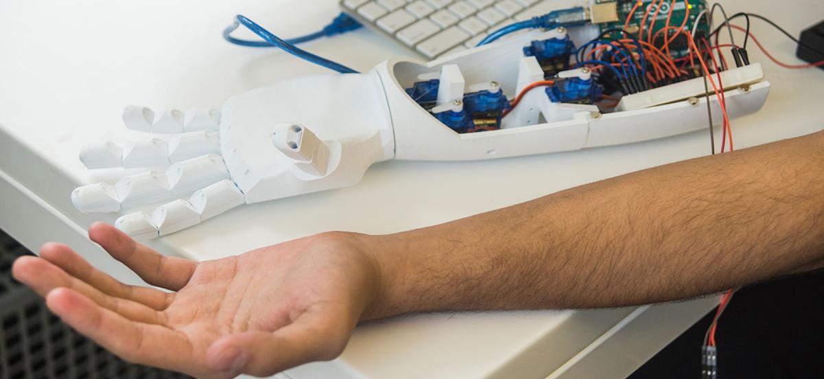 Robotic prosthetic arm next to Mohamed Ali's arm and a computer